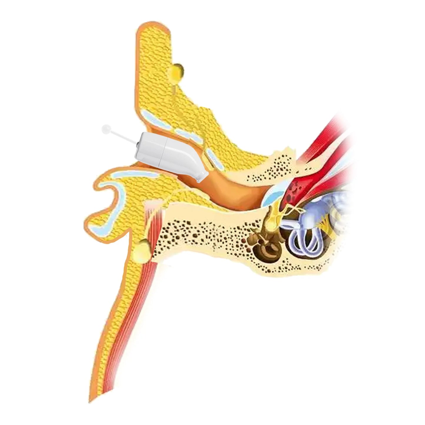 Ceretone Core One Pro CIC