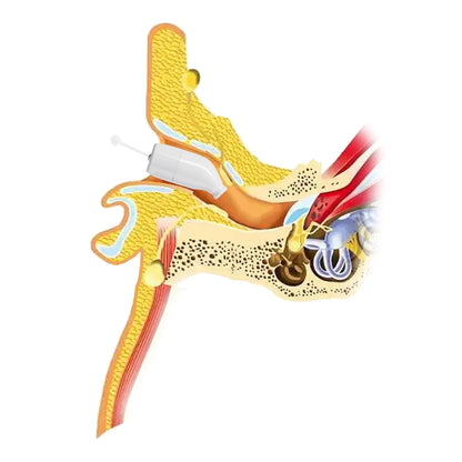 Ceretone Core One Pro CIC